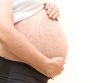 Крапивница при беременности: безопасное лечение