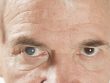 Начальная катаракта: симптомы, лечение