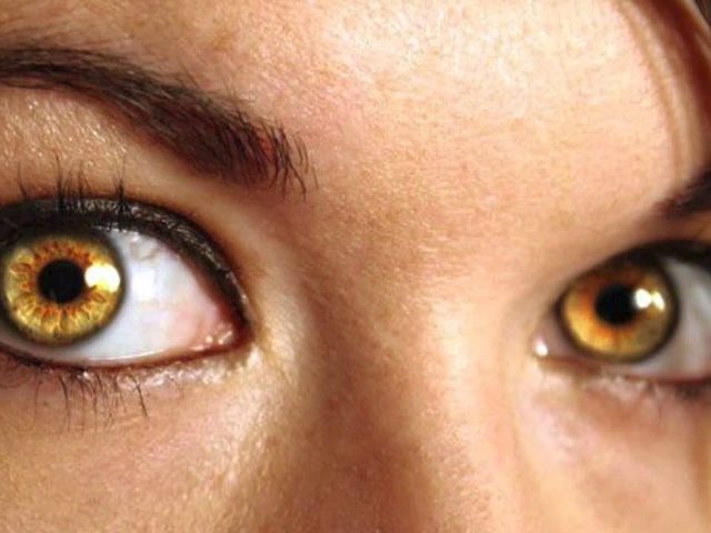 Желтый цвет глаз: что это может означать