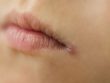 Чем можно вылечить трещины в уголках губ